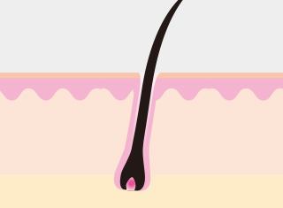 레이저제모 시술과정_1