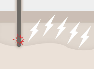백반증·건선 치료_1