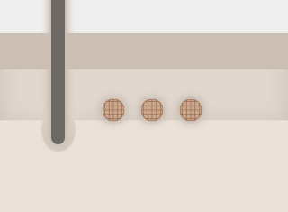 백반증·건선 치료_3