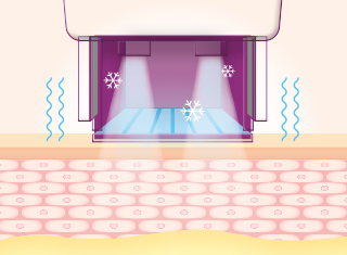 써마지FLX 시술과정_2