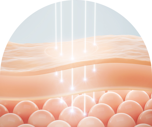 초음파리프팅 피부층사진