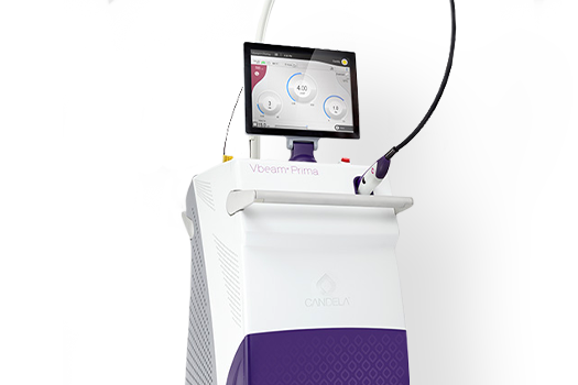 브이빔프리마 장비사진